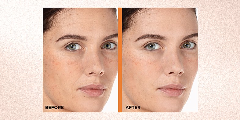 Before and after comparison